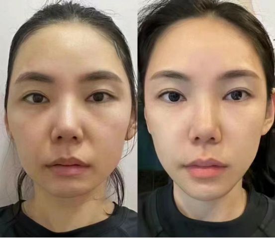 推荐2024最值得入手的抗皱国货分享j9九游会入口首页抗老去皱纹护肤品(图6)