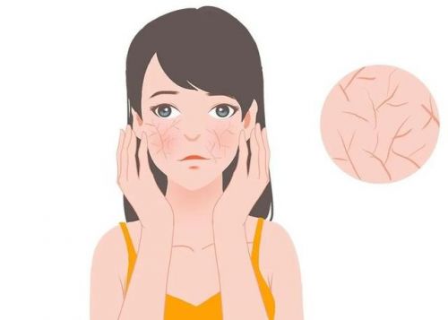 特护霜：修护敏感肌肤重塑健康屏障九游会登录j9入口第二代薇诺娜(图4)